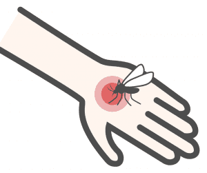 bug bite